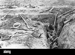 Image result for WW1 Battlefield Dead