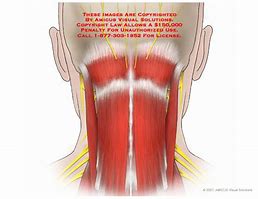 Image result for Cervical Vertebrae Labelled