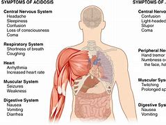 Image result for acidodis