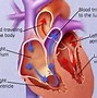 Image result for Cartoons About Pacemakers