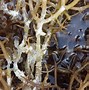 Image result for Crabs Infection