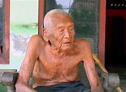 Image result for Oldest Person with Cyclopia
