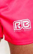 Image result for Rugby Injury