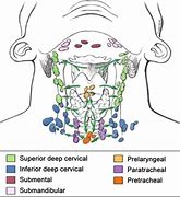 Image result for 2 Cm Lymph Node