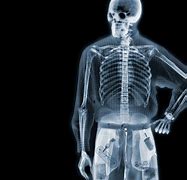 Image result for Amazing X-rays