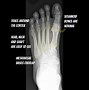 Image result for Child's Foot