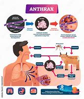 Image result for Anthrax Transmission