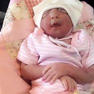 Image result for Pouting Anencephaly