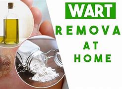 Image result for wart removal home remedies