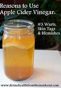 Image result for Apple Cider Vinegar Genital Warts