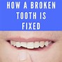 Image result for Broken Rotten Teeth