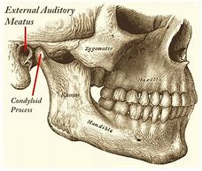 Image result for Anterior Wall of the External Meatus