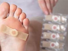 Image result for Plantar Wart Treatment