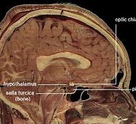 Image result for Gaoaxy Brain