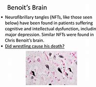 Image result for Benoit Brain