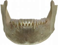 Image result for Skeletal Jaw