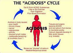 Image result for acidoeis