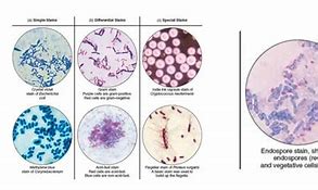 Image result for Diapax Stain