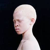 Image result for Albino Pepe