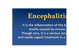 Image result for Encephalitis