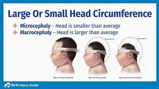Image result for Baby Head Circumference