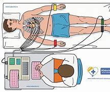 Image result for cardiograma