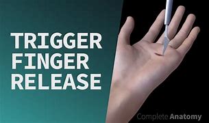 Image result for Trigger Finger Tendon Release