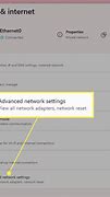 Image result for How to Change Network Connection Detail