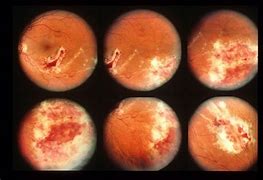 Image result for Portion of Retina with Rods