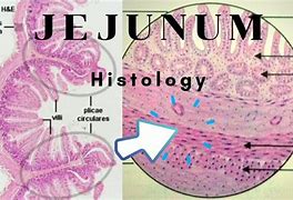 Image result for Jejunum Histology Labeled