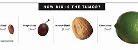 Image result for How Big Is a 2 5 Cm Tumor