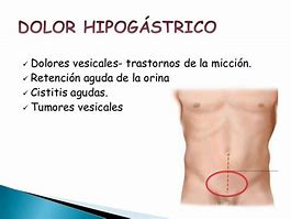 Image result for hipogastrio