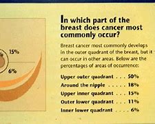 Image result for How Big Is 2 Cm Tumor