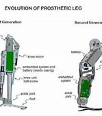 Image result for Bionic Limbs