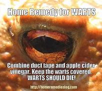 Image result for Common Wart On Finger Removal