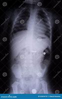 Image result for Batre HPDI X-ray
