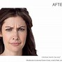 Image result for What's Botox Made Out Of