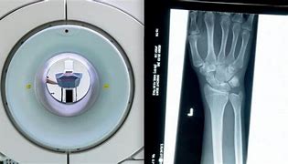 Image result for Medical Inventions