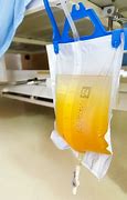 Image result for Pale Yellow Urine