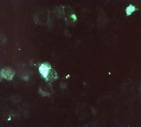 Image result for Chlamydia Bacterial