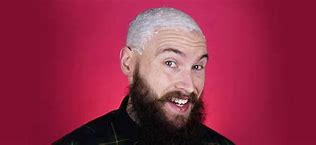 Image result for Harry Goes Bald