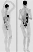 Image result for 3D Printed Human Scan