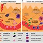 Image result for Chronic Inflammation Process