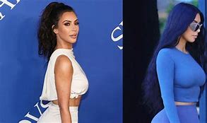 Image result for Kim Kardashian Acne