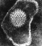 Image result for In Early Stages Genital Human Papillomavirus