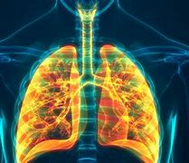 Image result for Cystic Fibrosis