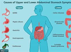 Image result for Common Digestive Diseases