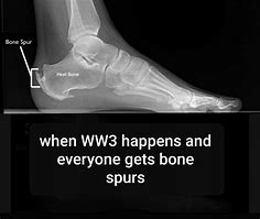 Image result for Cadet Bone Spurs Meme