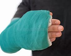 Image result for Arm Cast Fight