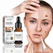 Image result for Salicylic Acid Ointment for Warts